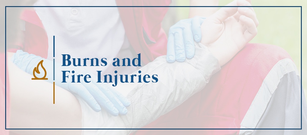 Burns and Fire Injuries | Personal Injury | KBG Injury Law