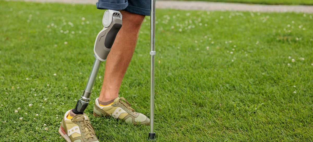 Lancaster Amputation Injury Lawyers